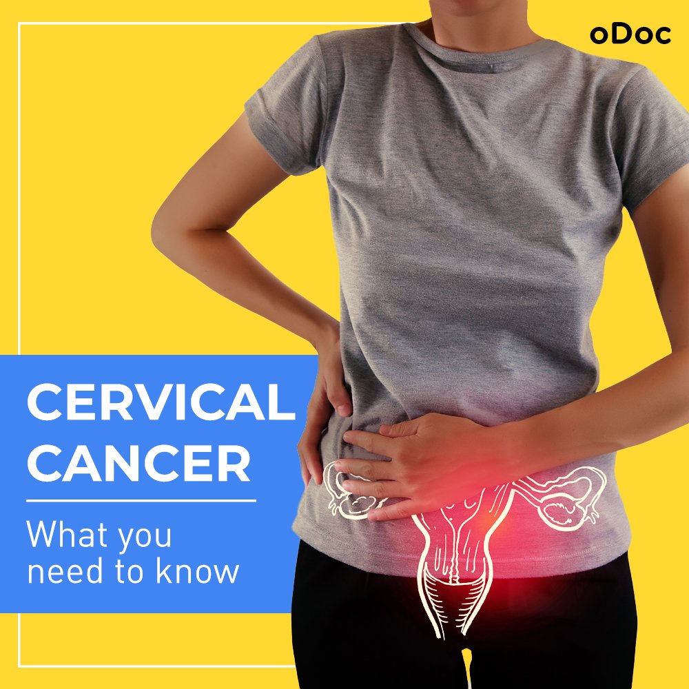 Cervical Cancer: What You Need To Know