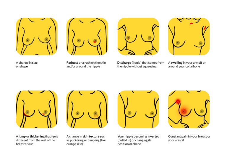 breast self-exam