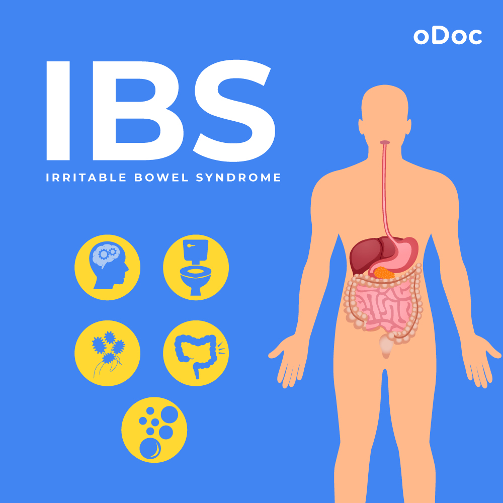 Irritable Bowel Syndrome (IBS)