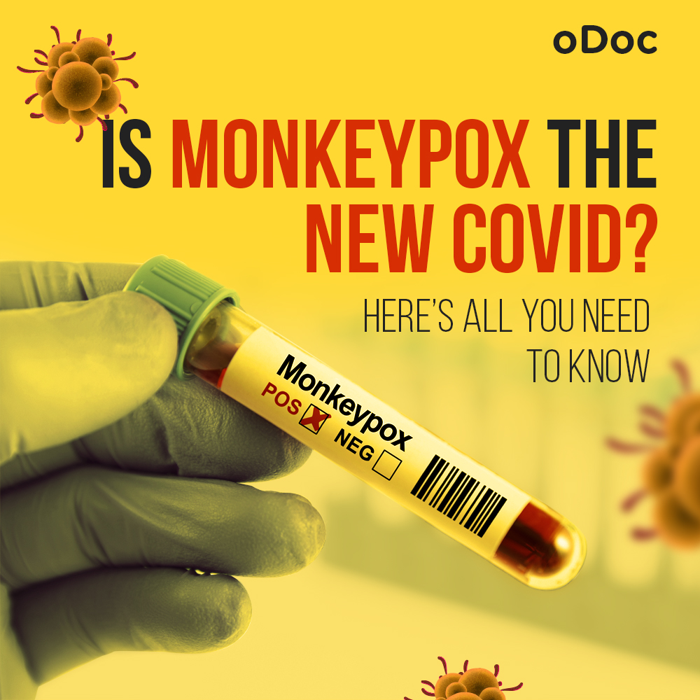 Is Monkeypox the New Covid? Here’s all you need to know