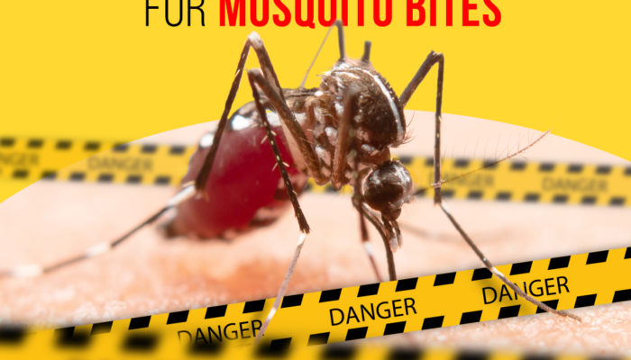 5 Home Remedies for Mosquito Bites
