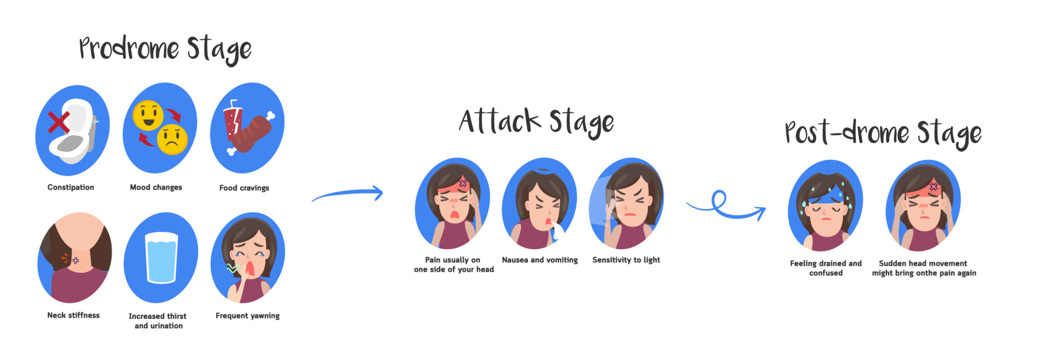 Stages of migraine