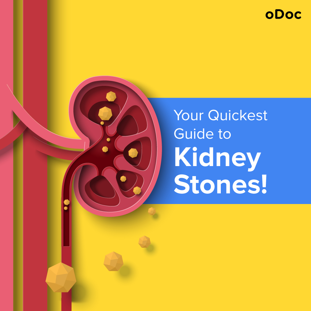 Understanding Kidney Stones: Its Symptoms, Causes and Treatment.
